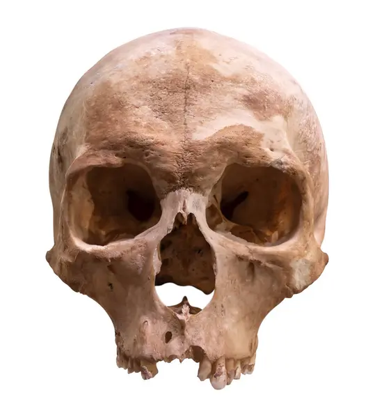Antico Cranio Umano Conservato Scienza Medica Isolato Uno Sfondo Bianco Fotografia Stock