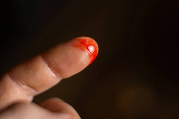 厨房里的手指被割破了 有伤口和血的男性手指 — 图库照片