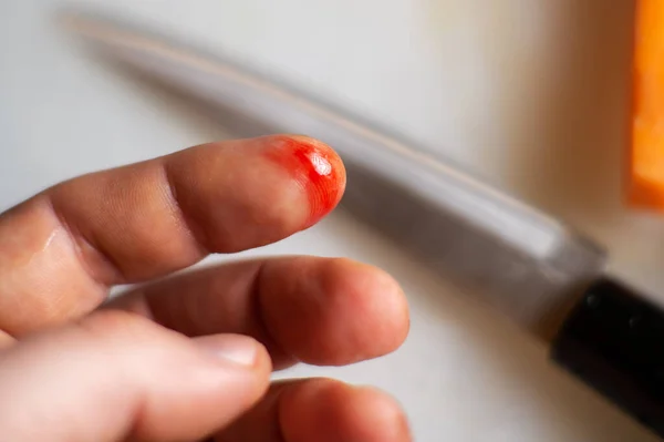 finger cut in the kitchen. Male finger with a wound and blood on a blurred background of a kitchen knife.