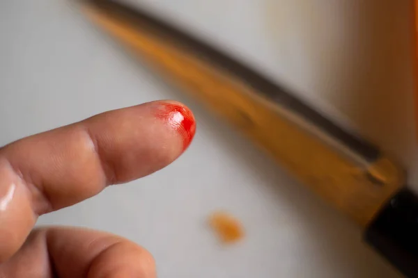 finger cut in the kitchen. Male finger with a wound and blood on a blurred background of a kitchen knife.