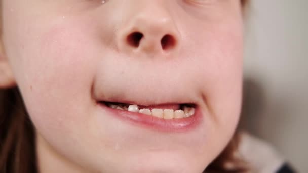 Makroaufnahme Des Mundes Eines Kleinen Jungen Mit Einem Wackeligen Zahn — Stockvideo