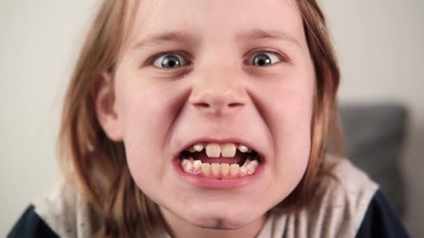 Uzun Saçlı Çarpık Dişlerini Göstermek Için Komik Suratlar Yapan Diş — Stok video