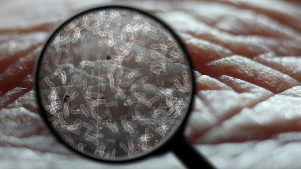 Zoek Naar Bacteriën Menselijke Huid — Stockfoto