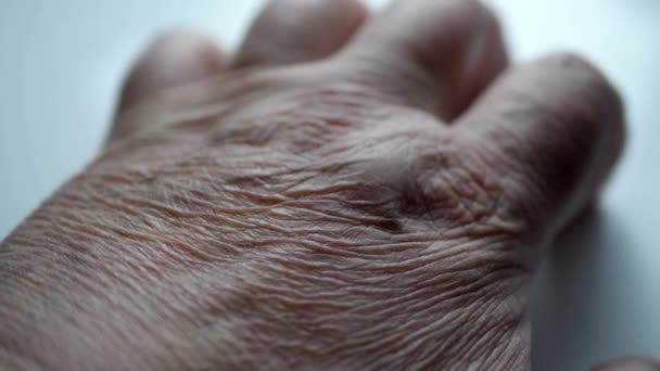 Senior Hand Alzheimer Disease — Stock Video