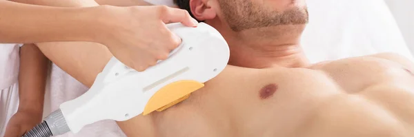 Men Spa Laserowe Usuwanie Włosów Kosmetologia Ipl — Zdjęcie stockowe