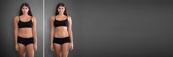 Körpervergleich Nach Abdominoplastik Diät Und Fettabbau — Stockfoto