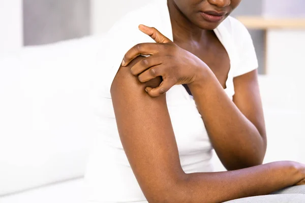 Mujer Afroamericana Con Piel Irritable Alergia Psoriasis —  Fotos de Stock