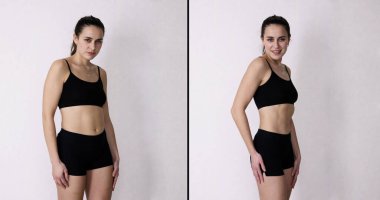 After After Weight Loss And Fat Liposuction