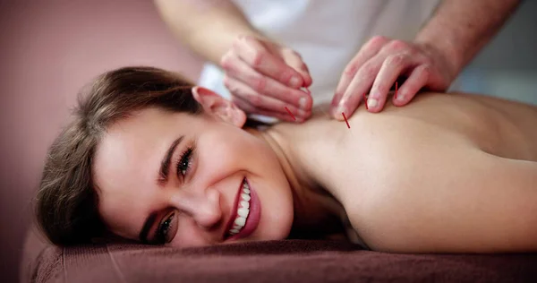 Kuru Ğne Akupunktur Tedavisi Kadın Tıbbi Spa Terapisi — Stok fotoğraf