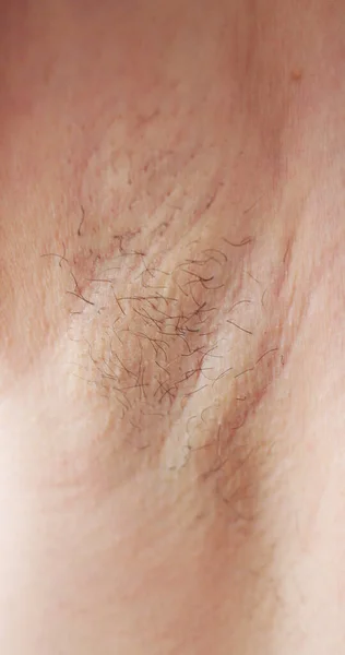 Mujer Joven Con Axila Peluda Depilación Afeitado —  Fotos de Stock