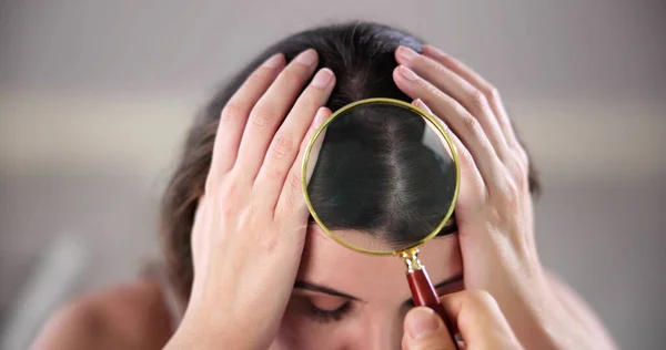 Masalah Belahan Kepala Gatal Dan Rambut Keramik — Stok Foto
