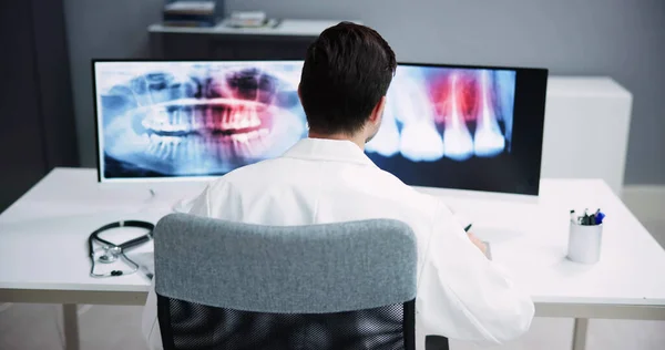 デスクトップコンピュータ上のX線ソフトウェアを使用して放射線科歯科医師 — ストック写真