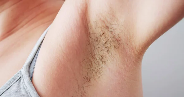 Mujer Joven Con Axila Peluda Depilación Afeitado — Foto de Stock