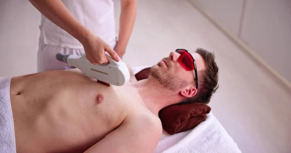 Erkek Lazer Saç Temizleme Epilasyon Tedavisi — Stok fotoğraf