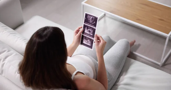 特写的孕妇坐在沙发上看着超声扫描 — 图库照片