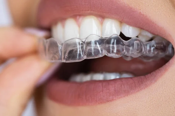 Diş Hücresi Gece Bekçiliğini Temizle — Stok fotoğraf