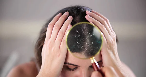 かゆみ頭皮と髪の毛の擦れ問題 — ストック写真