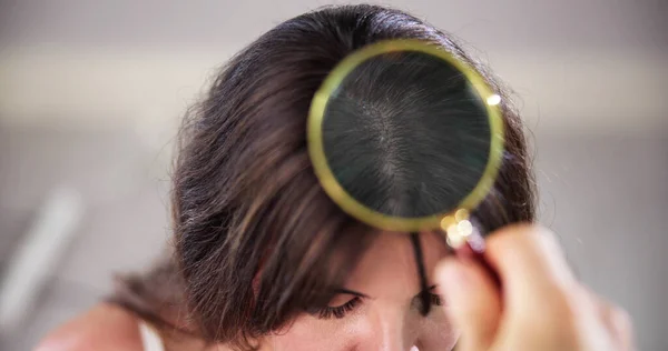 Πιτυρίδα Μαλλιών Και Φαγούρα Scalp Πρόβλημα Θεραπεία — Φωτογραφία Αρχείου
