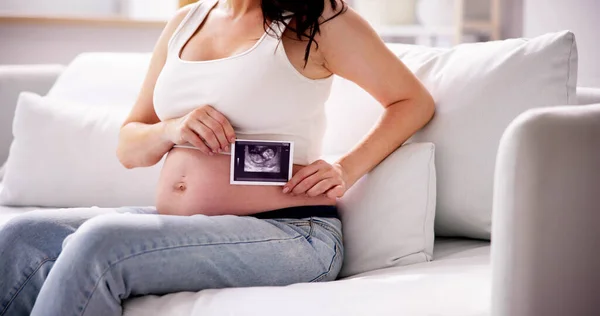 Detailní Záběr Těhotné Ženy Ultrazvukem Fotografie Jejího Dítěte — Stock fotografie