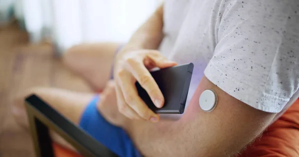 Homem Usando Sensor Diabetes Monitor Remoto Glicose Contínua — Fotografia de Stock