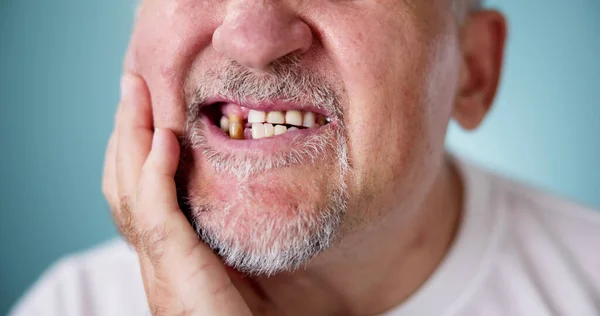 Yaralı Diş Çürük Erkek Diş Sağlığı Diş Ağız — Stok fotoğraf