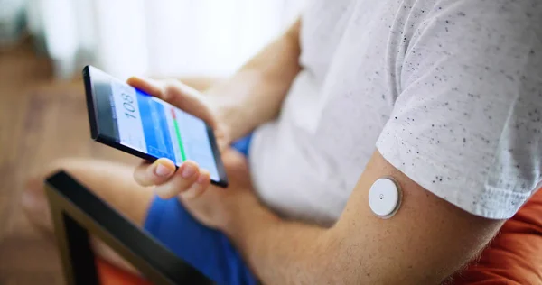 Homem Usando Sensor Diabetes Monitor Remoto Glicose Contínua — Fotografia de Stock