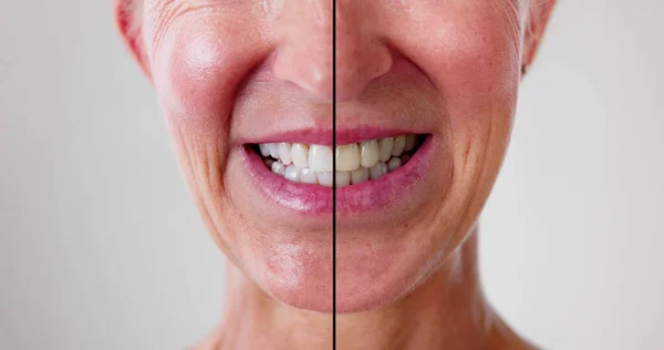 Γυναικεία Δόντια Μεταξύ Πριν Και Μετά Την Οδοντιατρική Θεραπεία — Φωτογραφία Αρχείου