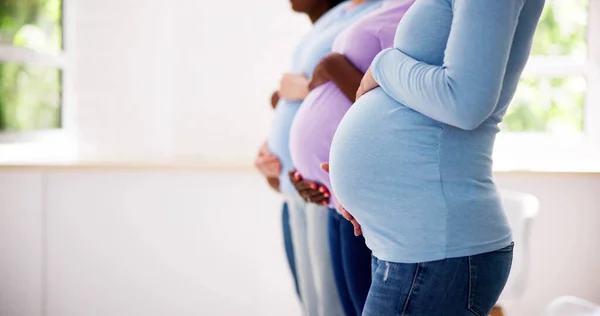 Těhotná Žena Skupiny Řadě Mladé Matky — Stock fotografie