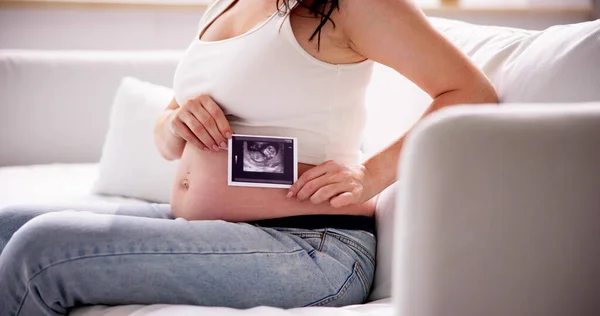 Close Uma Mulher Grávida Com Ultra Som Foto Seu Bebê — Fotografia de Stock
