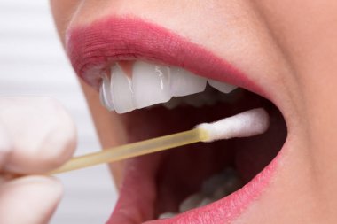 Dişçi el ile pamuklu çubukla kadın ağzından tükürük testi alarak