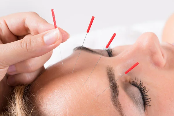 Closeup of hand performing acupuncture therapy on head at salon