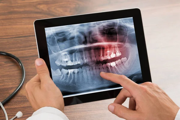 insan dişleri x-ray dijital tablet üzerinde arıyorsunuz doktor Close-Up