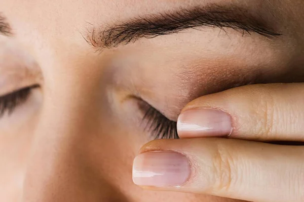 Cansado Agotado Dolor Ojos Problema Ache — Foto de Stock