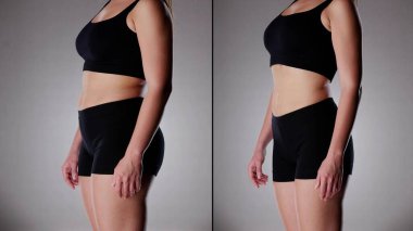 Kilo kaybından ve yağ aldırmadan önce