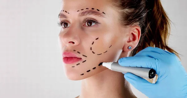 Estética Facial Lifting Facial Dibujos Cirugía Plástica Cara — Foto de Stock
