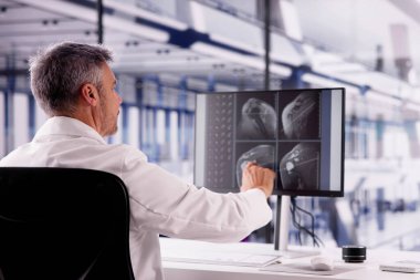 Doktor Bone X taramasına bakıyor.