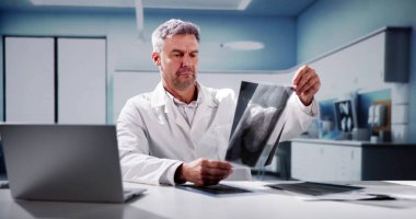 Doktor Bone X taramasına bakıyor.