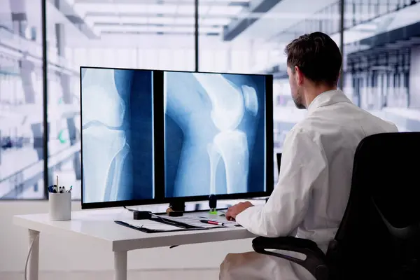 Doctor Screening Knee Bone Ray Computer — Stok Foto