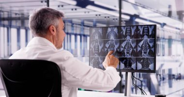 Doktor Tarama Omurgası Bilgisayarda X Ray