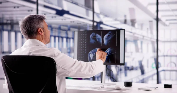 Doctor Screening Shoulder Bones X Ray On Computer