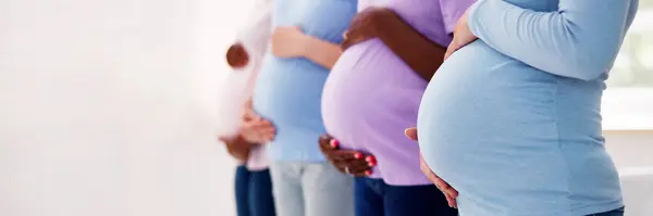 Diverso Grupo Mujeres Embarazadas Pie Fila Imagen de archivo