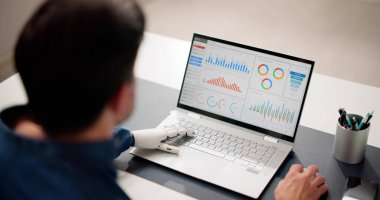 Protez eli dizüstü bilgisayarda çalışan bir adam. Yapay Ekstremite