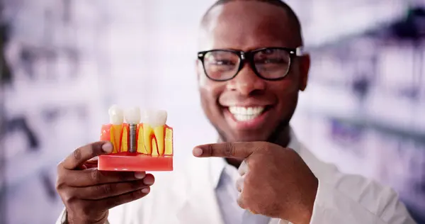 stock image Precision Technology in Dentistry: African American Man with Dental Implants and Ceramic Crowns Showcasing Cutting-Edge Dental Clinic Equipment