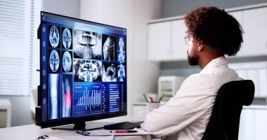 Bilgisayarda Doktor Tarama Dizi Röntgeni