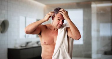 Adam saç dökülmesinden muzdarip. Dermatoloji Hasarlı Kafa Derisi