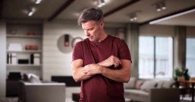 Man With Itchy Skin. Allergy Or Psoriasis