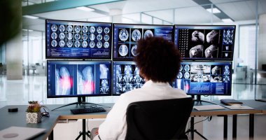 Erkek doktor MRI beyin taramasını yakından incelemek için bilgisayar kullanıyor..