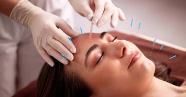 Akapunkturcu, kaplıcada genç bir kadının yüzüne iğneler batırıyor..