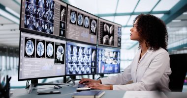 Doktor Xray Resimlerine Bilgisayar Yazılımı Kullanarak Bakıyor