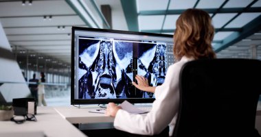 Kadın Doktor Bilgisayar Ekranında Hastanın Ayağının X-Ray 'ini inceliyor